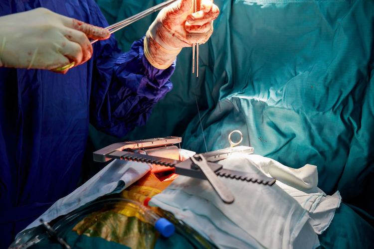 Midsection of doctor doing surgery of patient