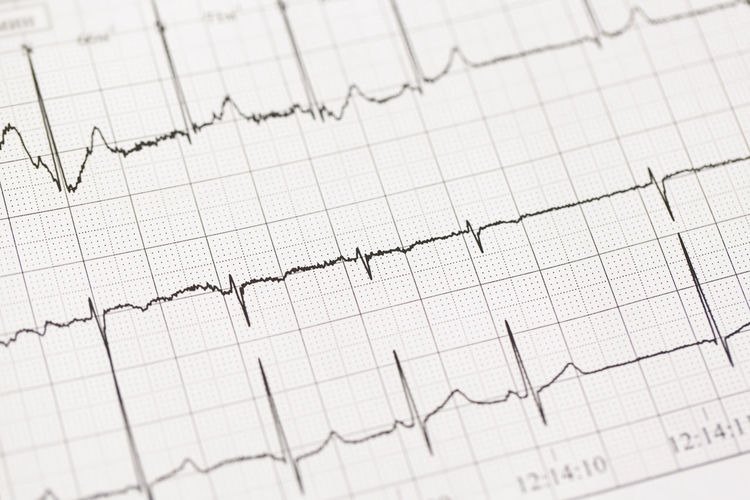 Close up of ecg, electrocardiogram. the work of a healthy heart on paper.