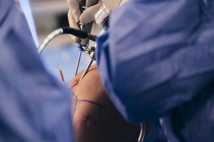 Doctor inserting endoscopic equipment while doing operation at operating room