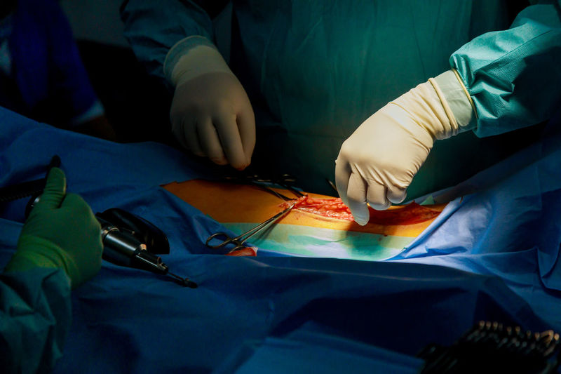 Midsection of surgeon operating patient at operating room