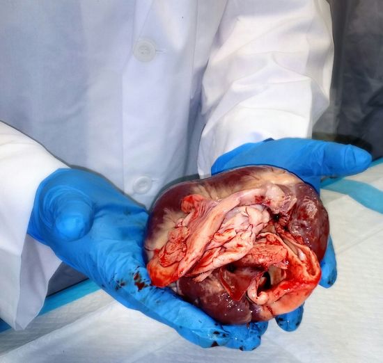 Close-up of gloved hands holding human heart