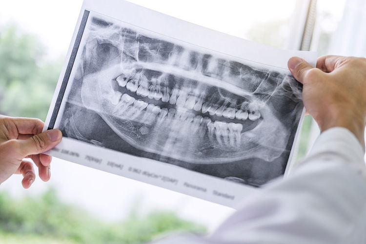 Cropped image of dentist examining x-ray
