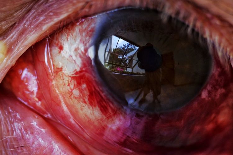 Macro close-up of a bloodshot eye.