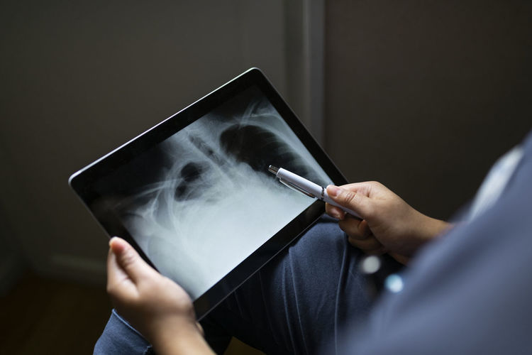 Hands holding digital tablet showing x-ray