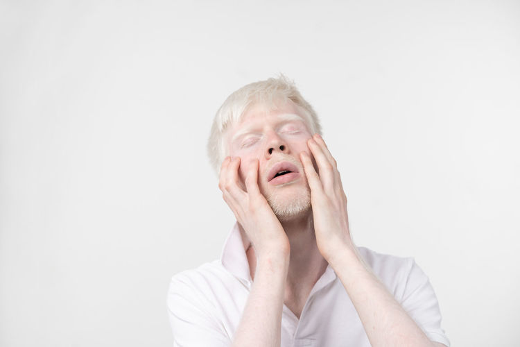 Close-up of man with albino with hands on cheeks against white background