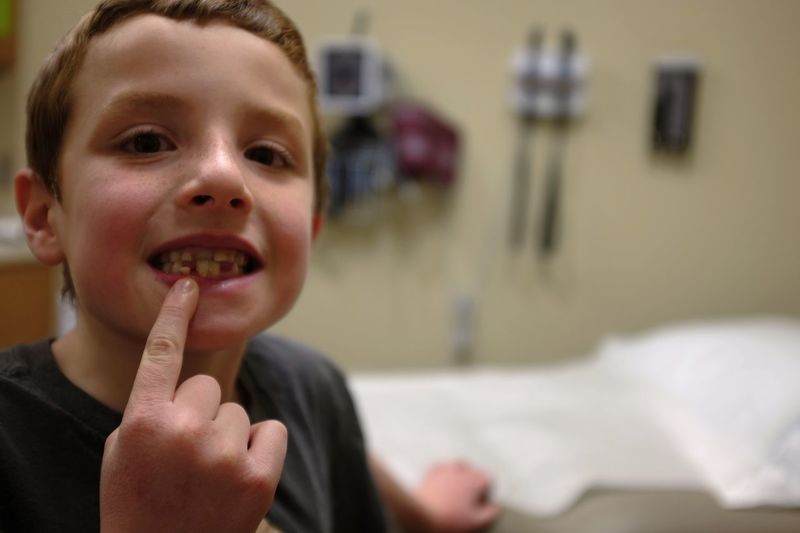 Portrait of boy showing broken tooth at dental clinic