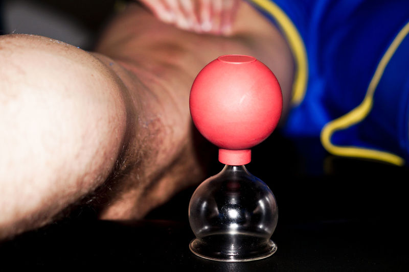 Close-up of vacuum cupping therapy 