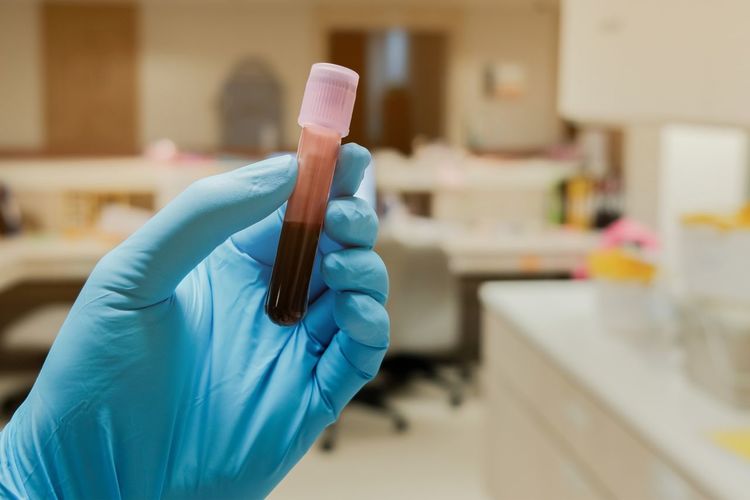 Close-up of hand holding blood sample in laboratory