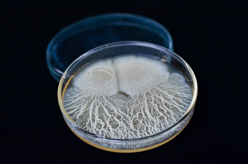 Beautiful bacterial colonies of bacillus sp growing on agar plate